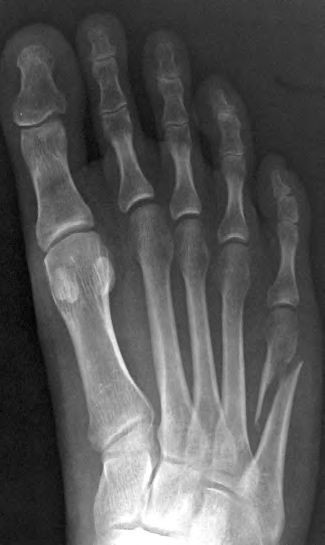 X-Ray der Hand