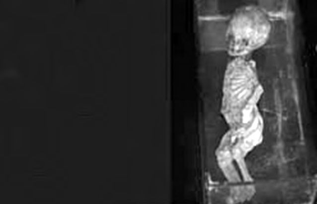 Ein schwarz-weißes Bild eines Skeletts.