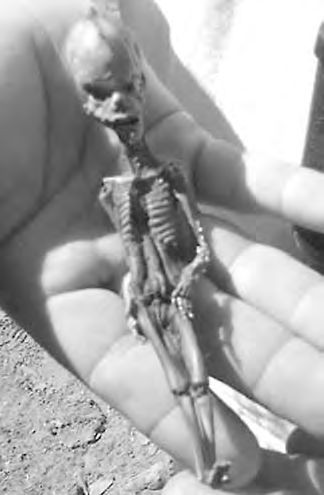 Ein schwarz-weißes Foto eines Skeletts in einer Hand.